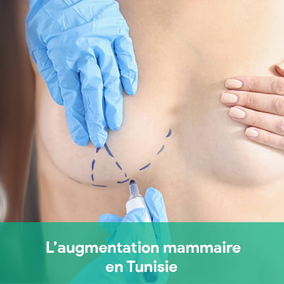 augmentation mammaire tunisie