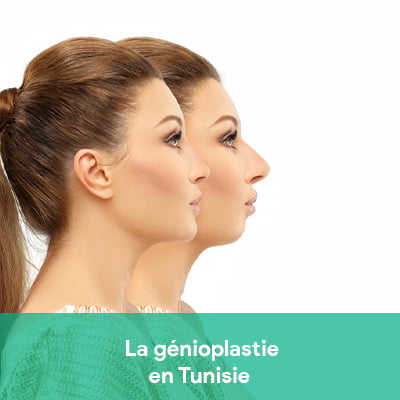 génioplastie tunisie