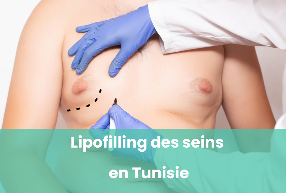 Lipofilling des seins en Tunisie