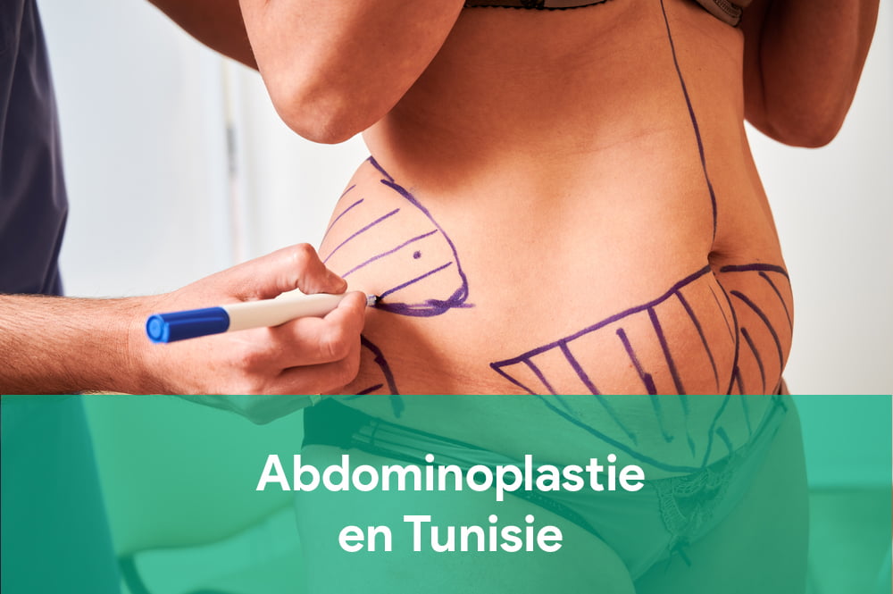 plastie abdominale Abdominoplastie en Tunisie : Prix et Informations