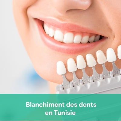 blanchiment des dents Tunisie