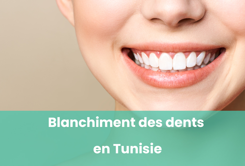 Blanchiment des dents Tunisie