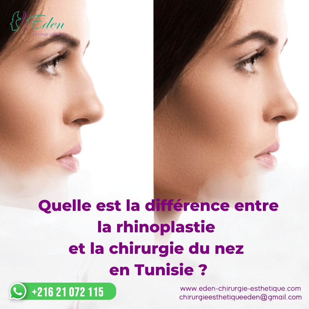 Chirurgie du Nez en Tunisie