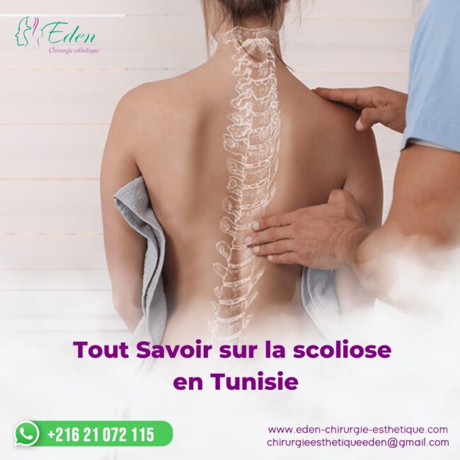 Tout Savoir sur la scoliose en Tunisie 