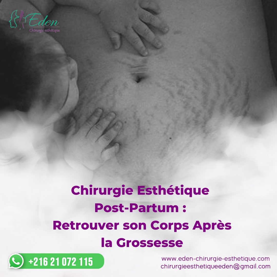 chirurgie esthétique post-partum en Tunisie (Mommy Makeover)