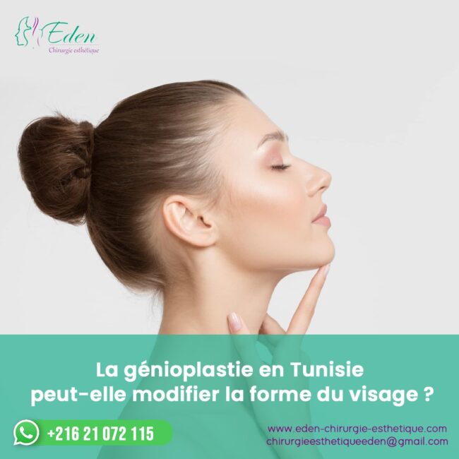 génioplastie en Tunisie